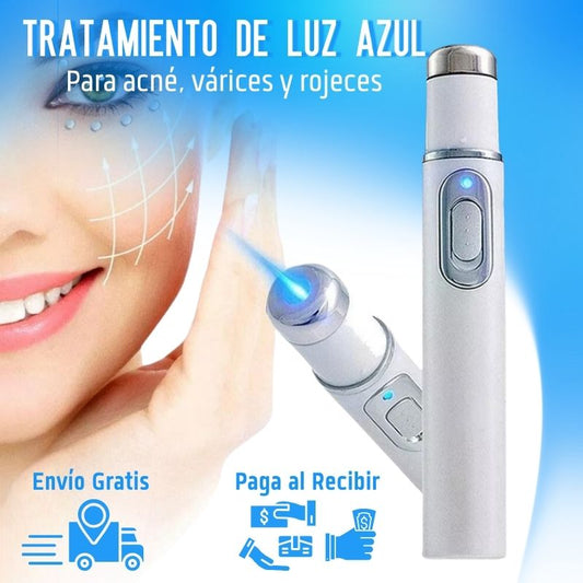 Tratamiento de Luz Azul para Acné